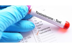 Последни данни от Терапия с Тестостерон 2020